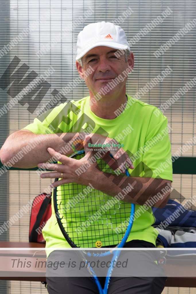 Tennis coach Julian Cousins showing a scar from an operation on his arm